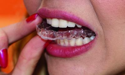 traitement orthodontique marseille 5