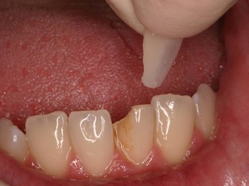 centre dentaire marseille 13005